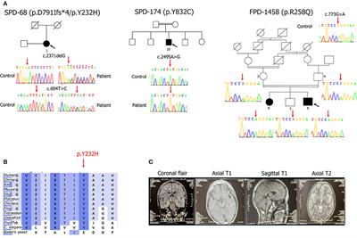 Clinical Variability of SYNJ1-Associated Early-Onset Parkinsonism